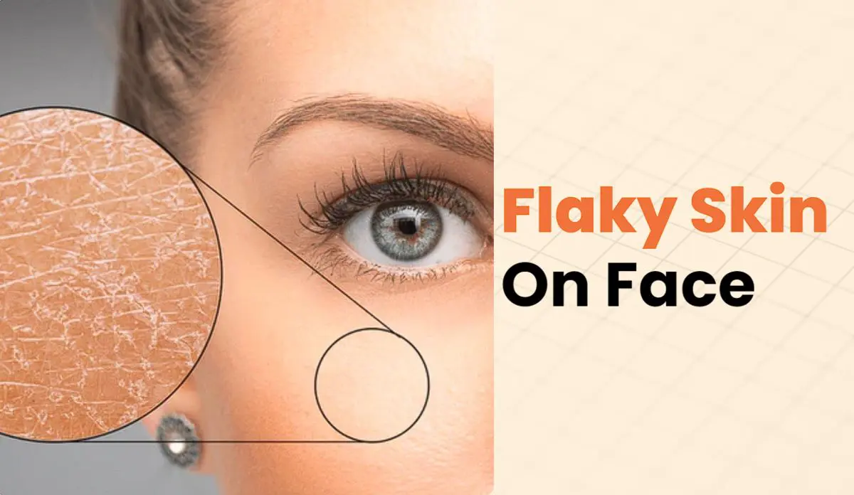 Flaky Skin on Face That Won't Heal