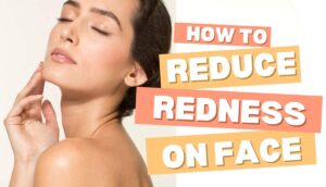 How to Reduce Redness on Face Quickly at Home