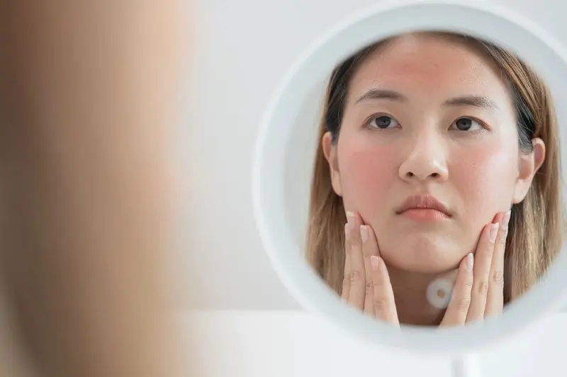 How to Take Care of a Dry Skin